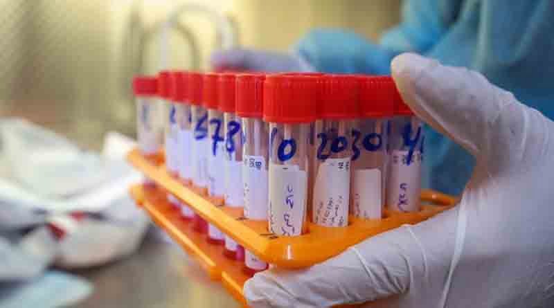Omicrôn já representa 92% dos testes positivos no Brasil
